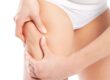 How Can I Get Rid of My Cellulite?