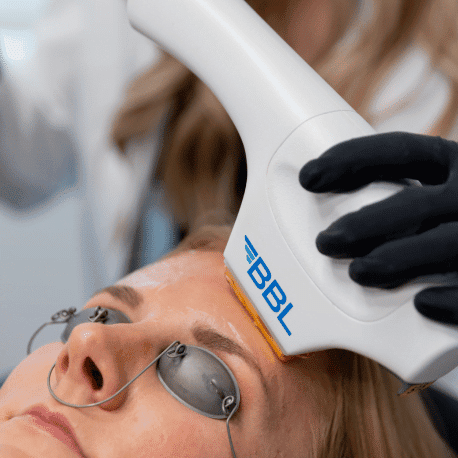 Reverse Signs Of Aging By Combining BBL + MOXI | RUMA Aesthetics