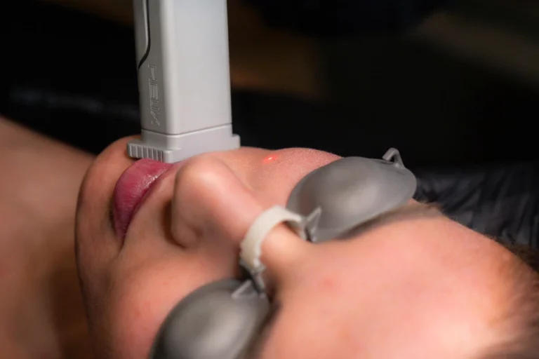 Helix Laser Resurfacing Customizable Skin Rejuvenation