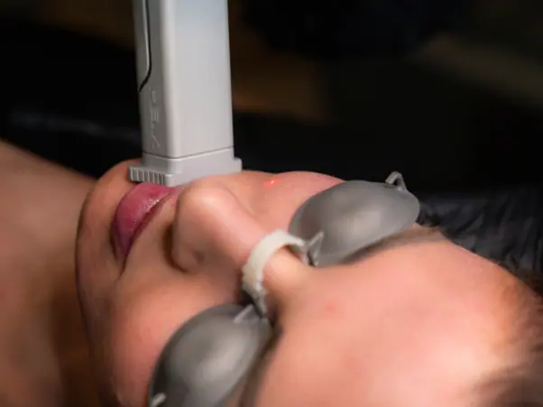 Helix Laser Resurfacing