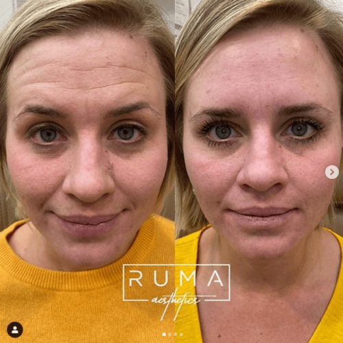 Before and After Images