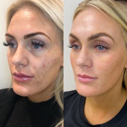 before-and-after-images-Fifty-seven-UT-Ruma_Aesthetics